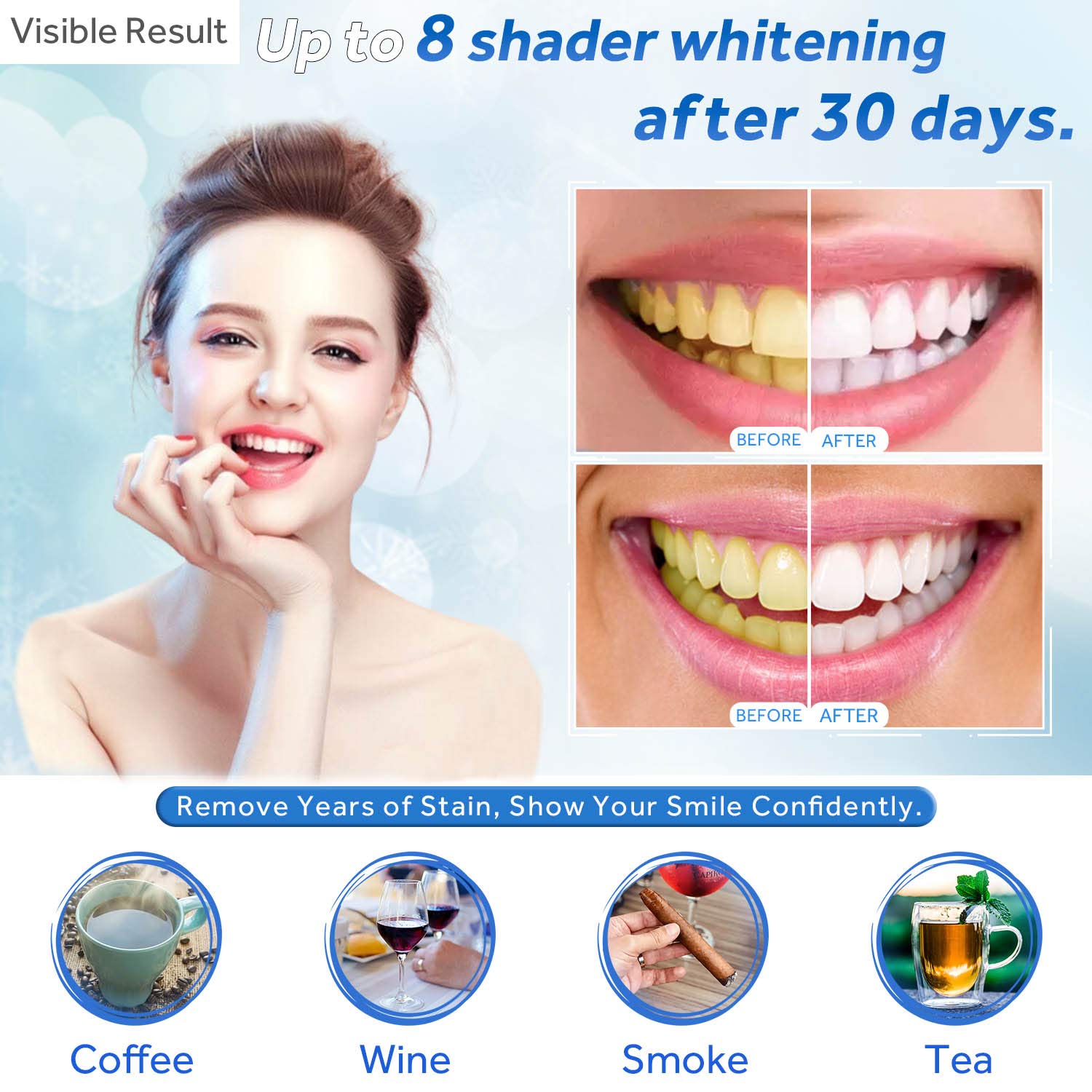 Diş Beyazlatma Jeli Dolum Şırı - Teeth Whitening Singapore incelemesi ve fiyatı