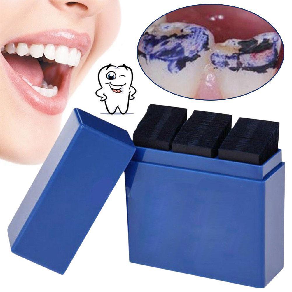 300 yaprak diş eklemleme kağıd - Teeth Whitening Retainer incelemesi ve fiyatı