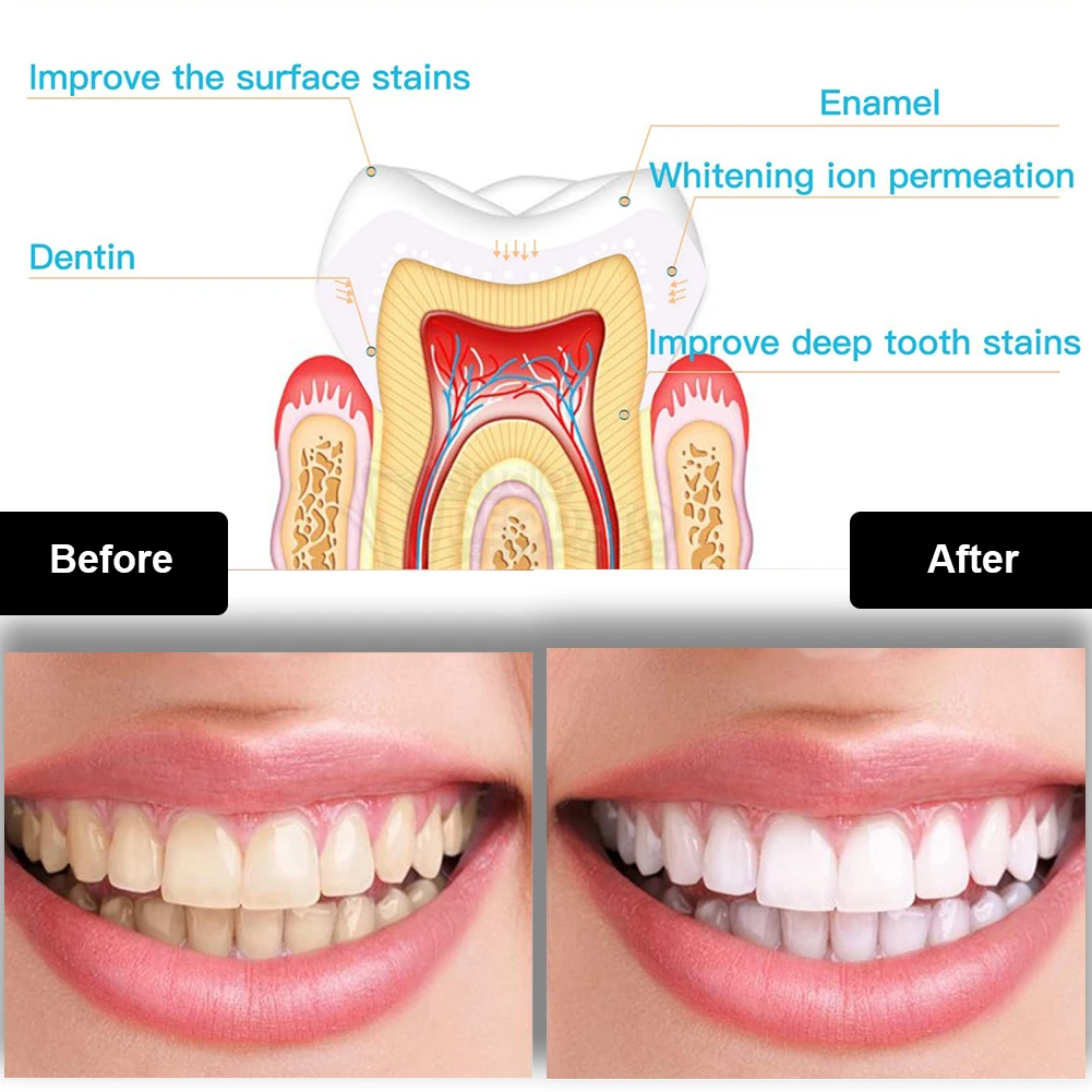 Diş Diş Beyazlatma Kiti Mini 1 - Teeth Whitening Singapore incelemesi ve fiyatı